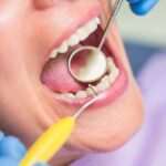 artritis-reumatoide-e-higiene-bucodental-descubre-la-importancia-de-cuidar-tu-boca