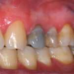 Causas de los dientes oscuros y cómo solucionarlo causas-de-los-dientes-oscuros-y-como-solucionarlo