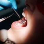 El método revolucionario que elimina las caries al instante método revolucionario que elimina las caries