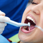 Lo que necesitas saber sobre el curetaje dental: ¡Información relevante! lo-que-necesitas-saber-sobre-el-curetaje-dental-informacion-relevante