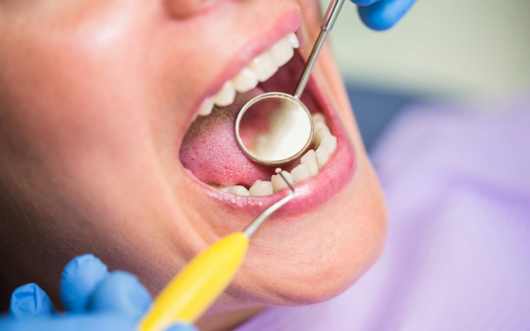 maloclusion-dental-detecta-los-sintomas-y-busca-soluciones