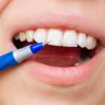 Manchas blancas en los dientes: ¡todo sobre su origen y prevención! manchas-blancas-en-los-dientes-todo-sobre-su-origen-y-prevencion