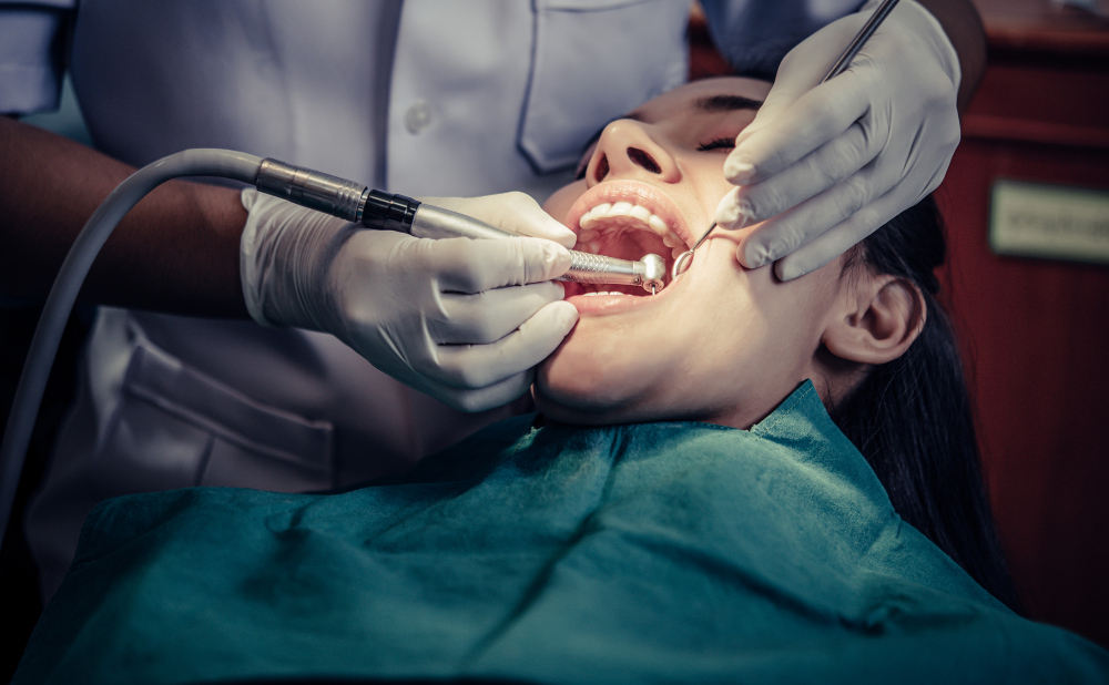 obturacion-dental-todo-lo-que-necesitas-saber