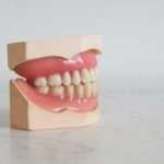 prognatismo-mandibular-causas-y-tratamientos-para-corregirlo