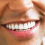 Tratamientos de implantes dentales: ¡Recupera tu sonrisa perfecta! tratamientos-de-implantes-dentales-recupera-tu-sonrisa-perfecta