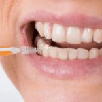 uso-de-cepillos-interdentales-e-hilo-dental-potencia-tu-higiene-oral