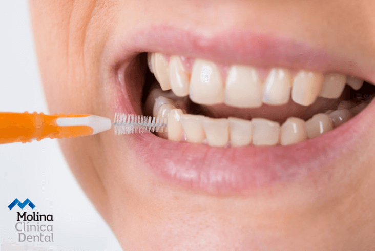 uso-de-cepillos-interdentales-e-hilo-dental-potencia-tu-higiene-oral