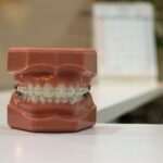 coronas-dentales-temporales