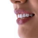 Cómo identificar la mejor clínica dental para tratamientos especializados implantes-casos-exito